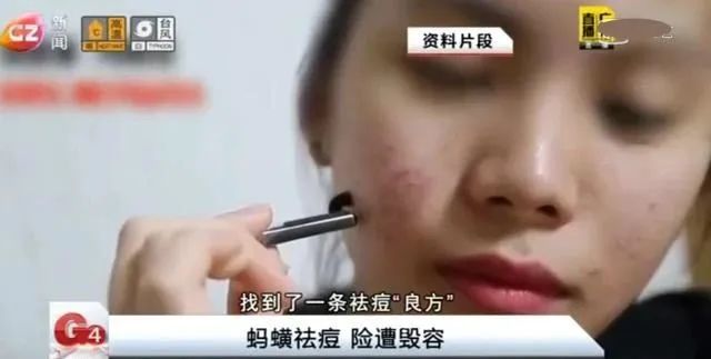 有哪些亲测有效的美容小妙招,美容都有什么偏方好用的