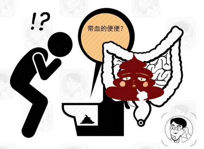 小心痔疮,日常生活该如何预防痔疮疾病