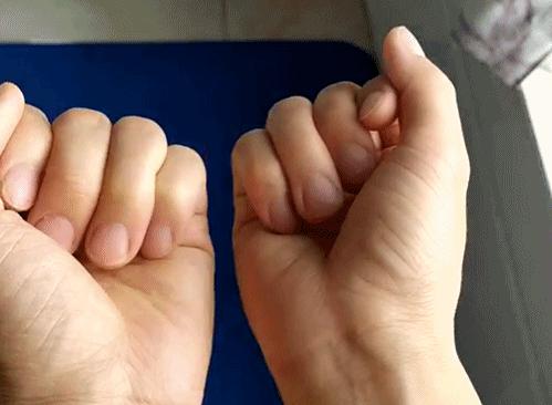 血糖高导致手脚麻木怎么治疗,如何不吃药缓解血糖高手脚发麻