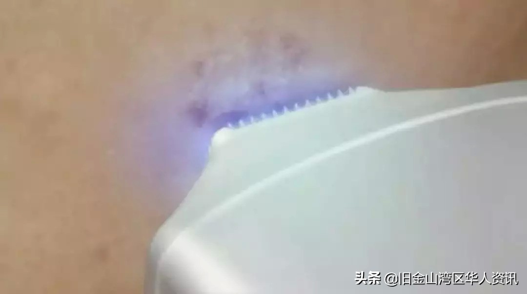 脸部处理ps,直接ps