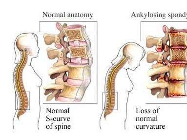 腰痛难起身怎么办,腰痛得坐立难安是怎么回事