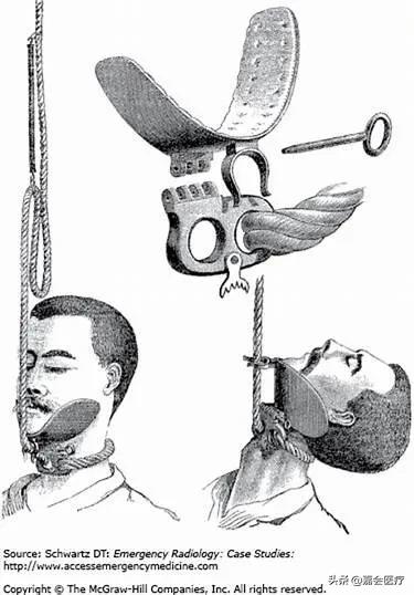 她被判处绞刑，吊了半小时却没死，这个医生说出了真相