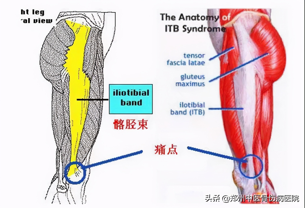 中医治疗股骨头坏死效果怎么样,中医是否可以治愈股骨头坏死