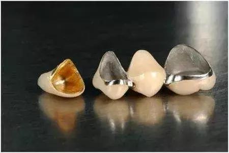 烤瓷牙和全瓷牙的优缺点是什么,钴铬合金烤瓷牙和全瓷牙优缺点