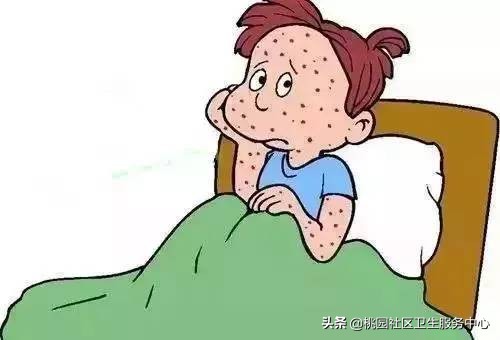 关于水痘高发期的注意事项,水痘的坑怎么消