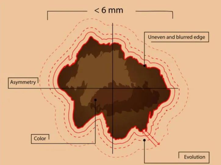 下一个可能攻克的癌症疫苗,德国抗癌疫苗最新消息何时临床