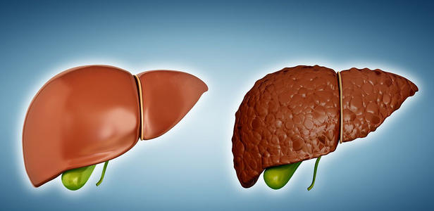 水果代替晚餐会得脂肪肝吗,吃蔬菜得脂肪肝