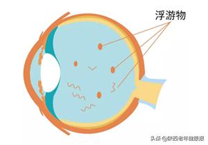 娓呮櫚瑙嗛噹涓嶄激鐜荤拑,娓呮櫚瑙嗗姏鏈夋病鏈夐槻钃濆厜鍔熸晥