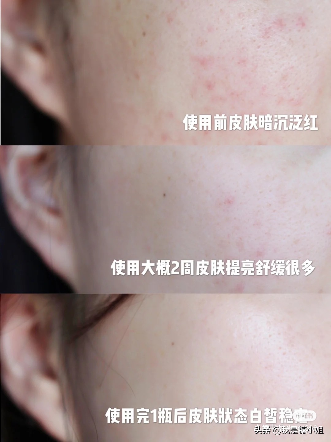 教你赚钱的美白产品,护肤品的利润要多少才赚钱