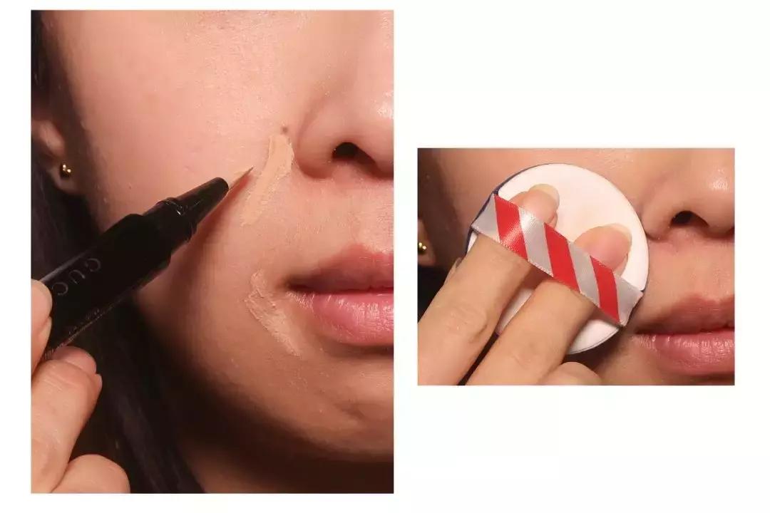 缇庡鐨偆绠＄悊鍖栧,缇庡闄㈠仛鑲岃偆閬憰