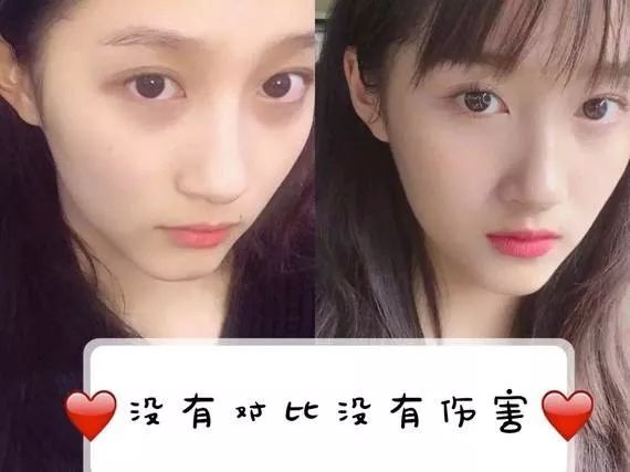 没有熬夜却有黑眼圈怎么消除,没熬夜的黑眼圈怎么去除