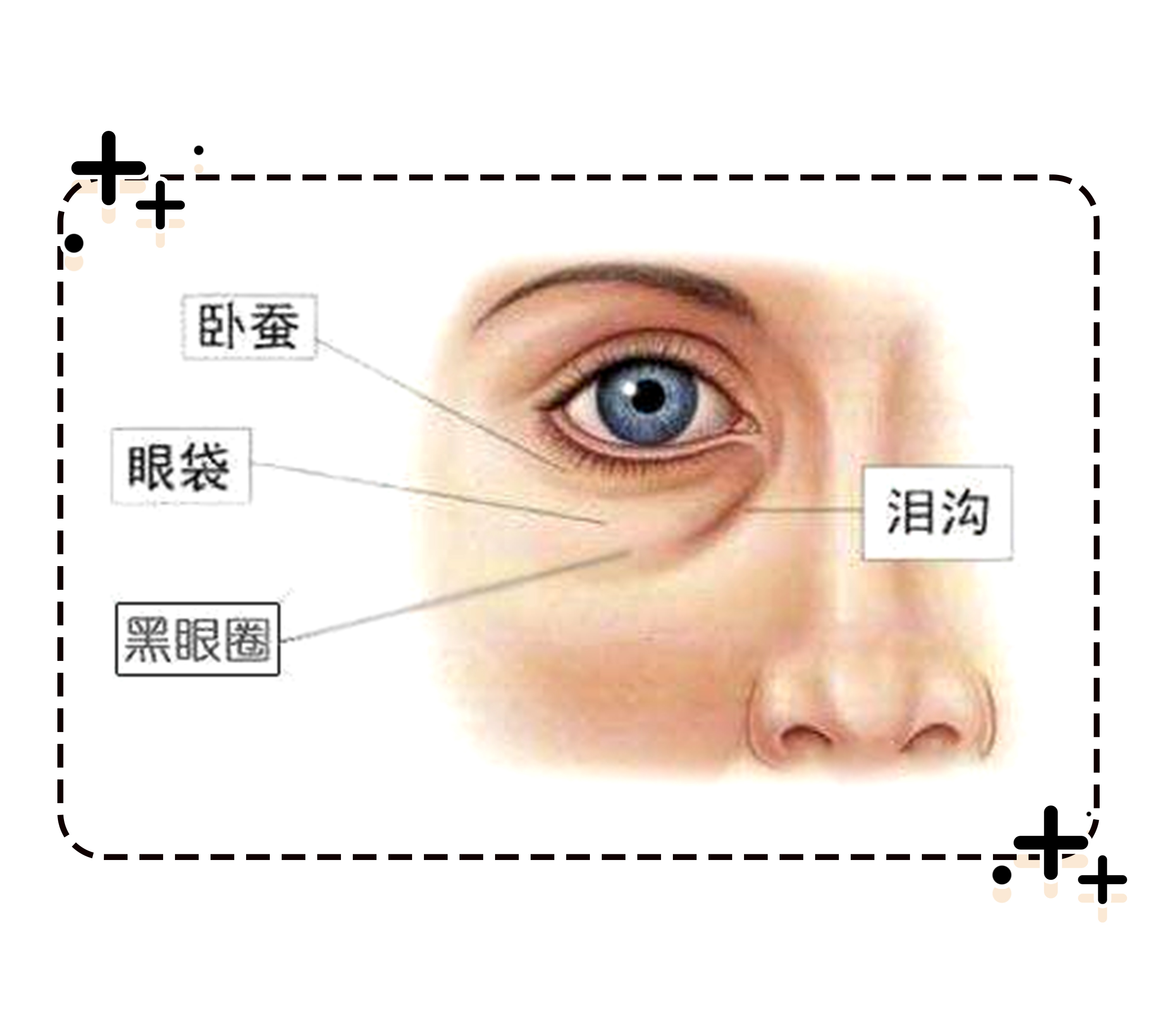 一篇漫画彻底了解“黑眼圈”的背后真相,这么“虚”有的救吗?