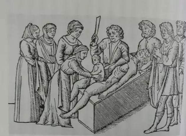 不麻醉的手术有多疼,无麻醉手术有多可怕