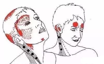 颈部胸锁乳突肌后部有结节,颈部胸锁乳突肌有一个包