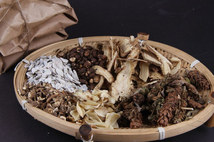 中医治疗前列腺增生患者1例,67岁,血尿,腰痛,小便不利