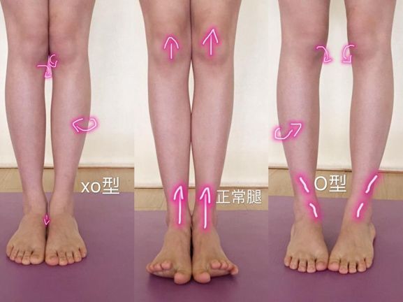 嫌腿粗的裤子怎么穿,如何选择与自己腿型适配的裤子