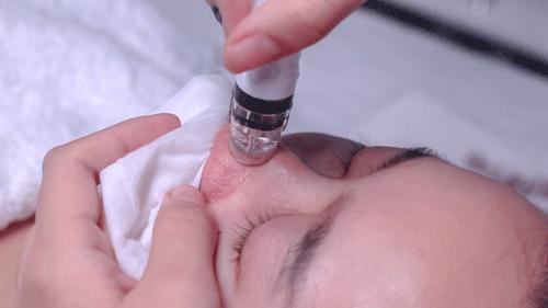 油肌如何控油,哪些简易方法有助于肌肤控油