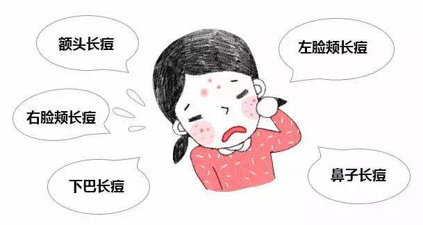 拯救痘痘肌肤的救星来啦,痘痘肌改善痘印产品推荐