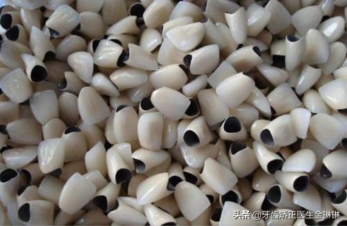 山东烤瓷牙什么牌子好,淄博市烤瓷牙价格