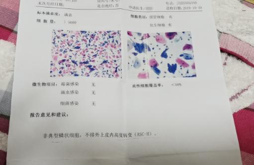 hpv16阳性活检无病变可以怀孕吗,29岁查hpv检查59阳性