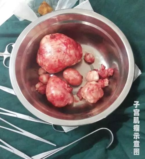 世界奇妙物语女子生孩子后续,世界奇妙物语之正午之战