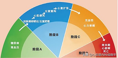 高血压，心脏肥厚了怎样选药？