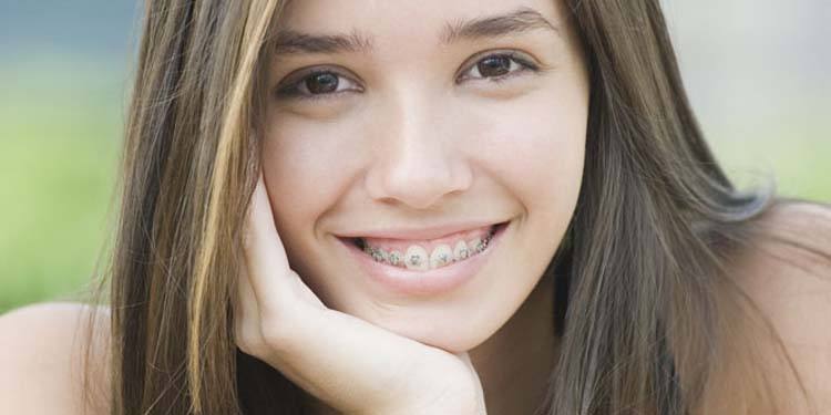 牙齐戴牙套可以改变脸型吗,戴牙套怎么才能不改变脸型