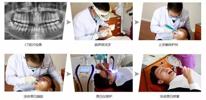 皓齿美白靠谱吗,做完皓齿美白牙齿特别疼