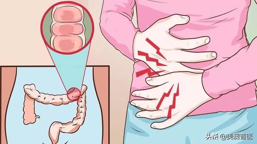 无痛胃肠镜前清肠怎样算干净,做肠镜清肠能把小肠清干净吗