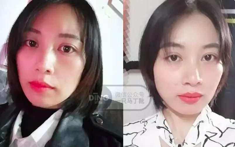 中庭又长又宽显老,中庭长怎么避免显老