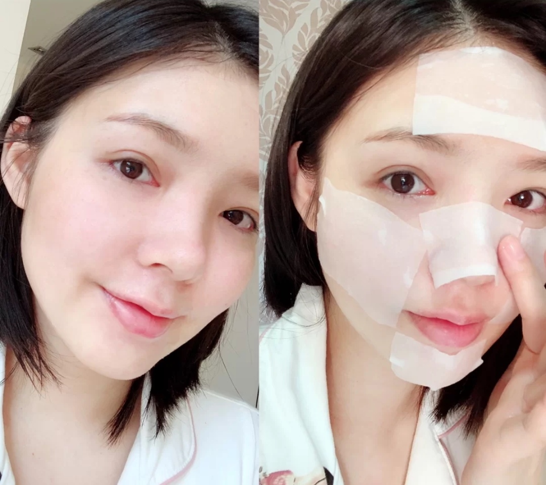 百元以下湿敷水祛痘印,百元以下爽肤水