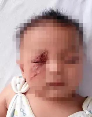 晚上玩手机会毁容的虫子,前一晚关灯玩手机被虫毁容