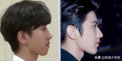 凸嘴有什么方法改善,形成嘴凸的原因