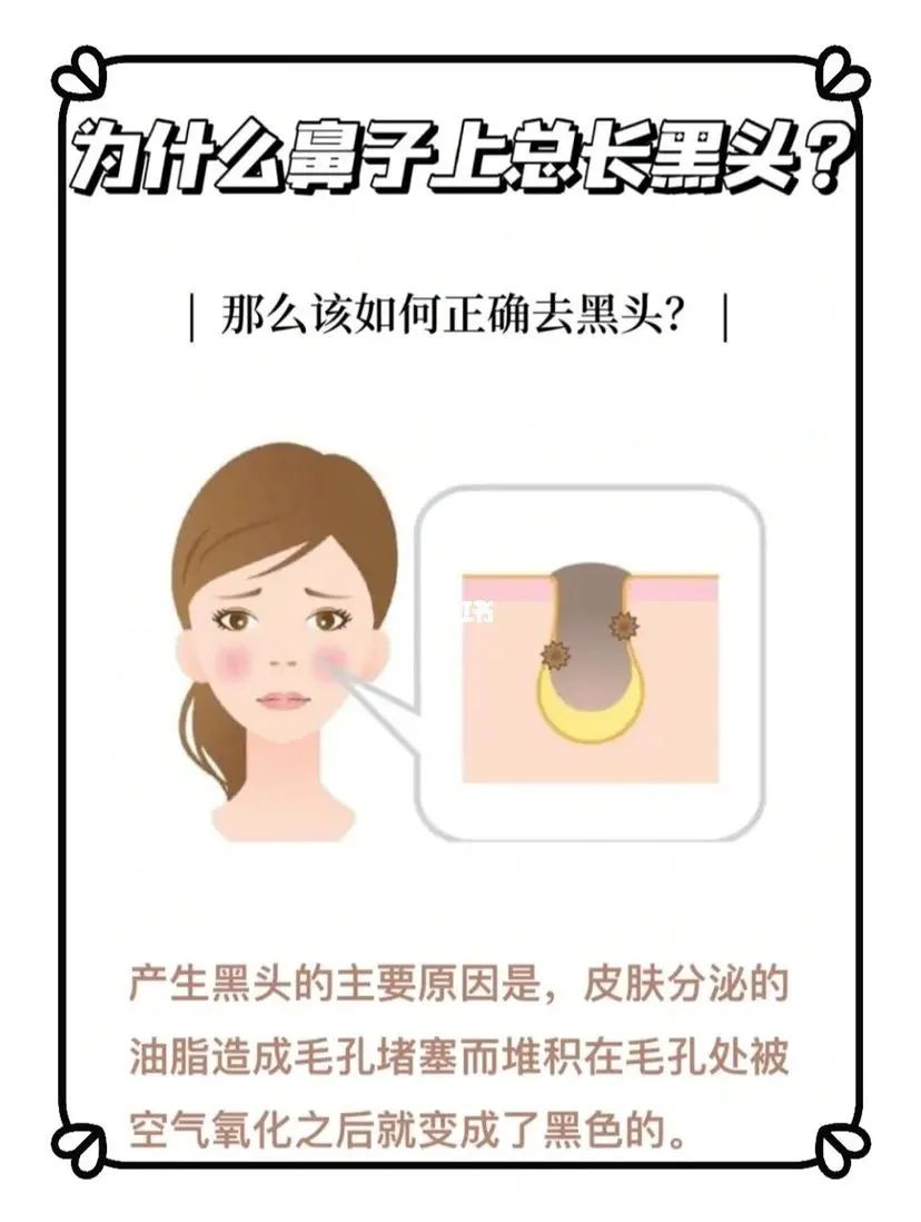 鼻子上去黑头过程,鼻子去黑头治愈系过程