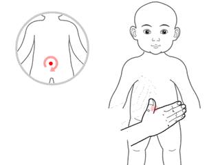 宝宝吃太多导致积食咳嗽,孩子吃得太多咳嗽是怎么回事