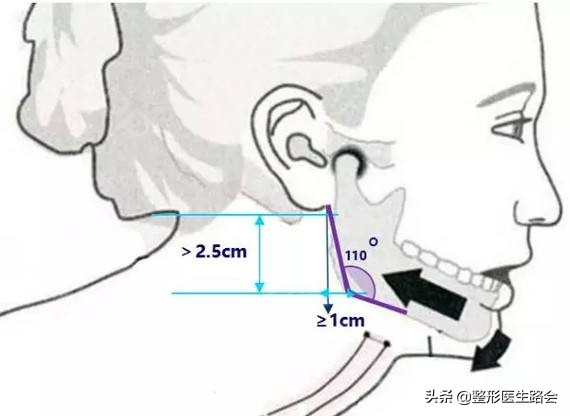 下颌角是天生的还是会给咬肌撑大,为什么脸大但是下颚线明显