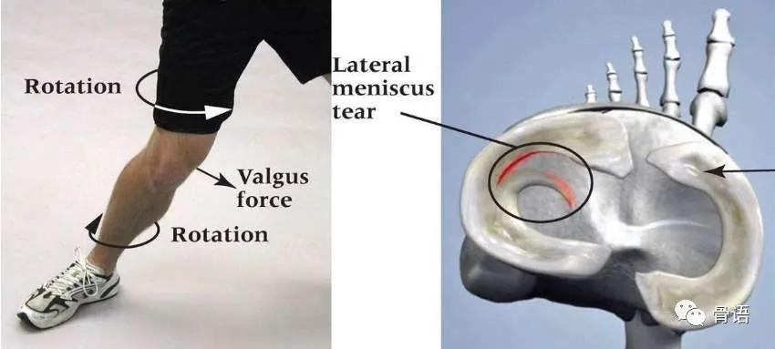 致敬韦德踩球,致敬韦德迷踪步