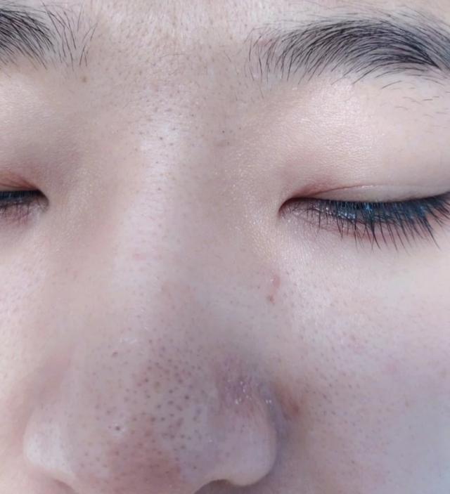 美容院去黑头前敷的东西,美容院去黑头面膜