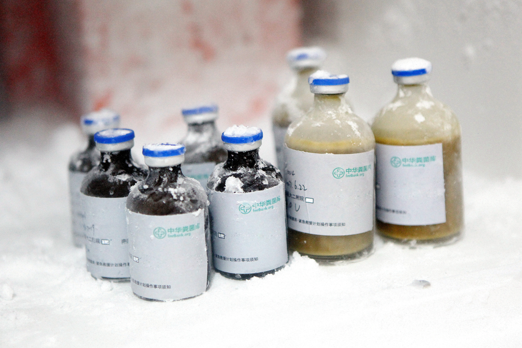 粪菌移植的历史,粪菌移植是新兴技术吗