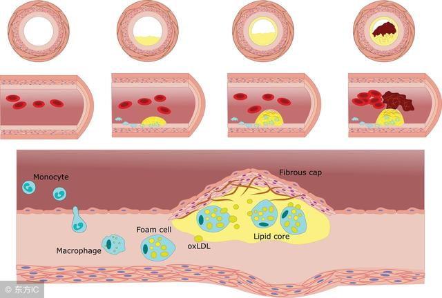 吃着降压药还是100到160怎么办,140-70血压需要吃降压药吗