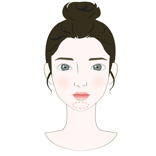 眉毛长痘的原因及解决方法,嘴边长痘是什么原因