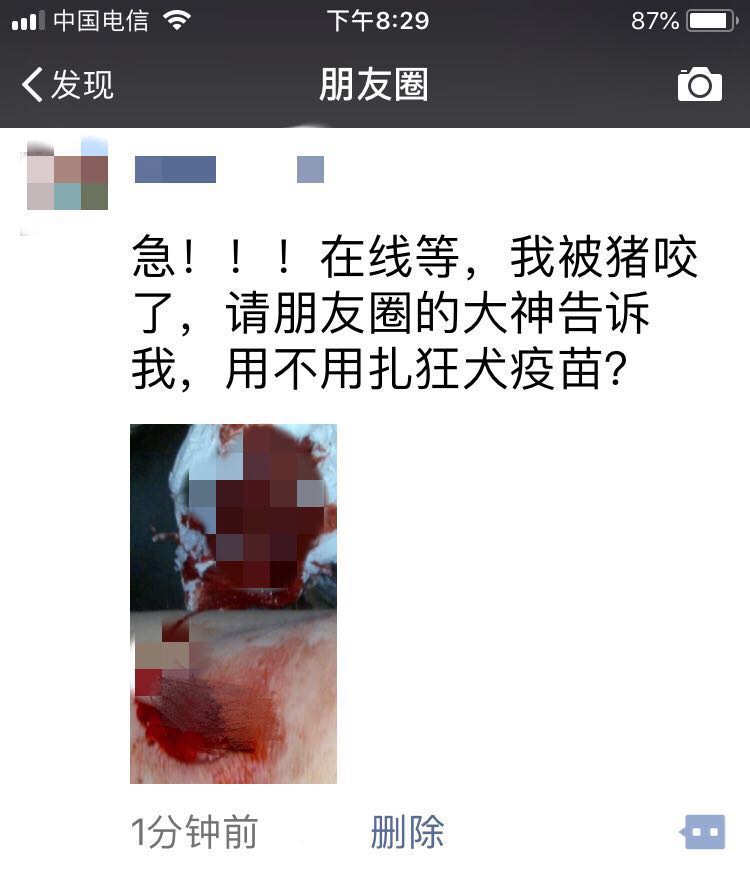 被猪咬了没有出血要打狂犬疫苗吗,猪咬着还打狂犬疫苗吗