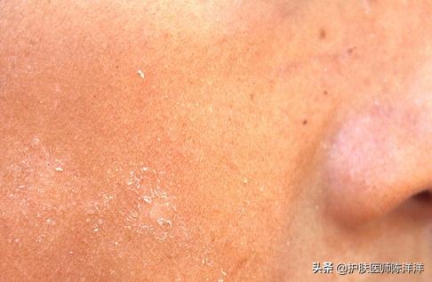 精准护肤首倡者丁慧教授对肌肤问题的现状与思考