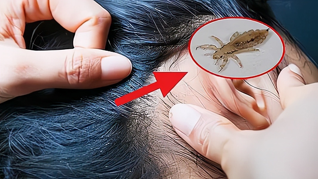 它们喜欢寄生在人的身体上行动迅速敏捷数量繁多