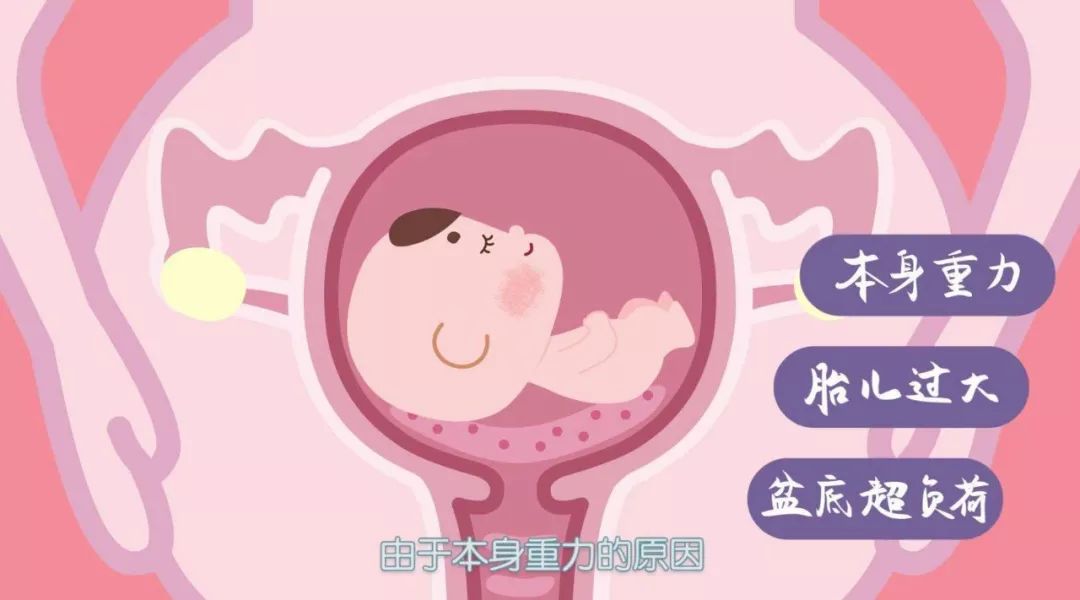 「盆底健康」重视盆底健康，笑迎安逸生活
