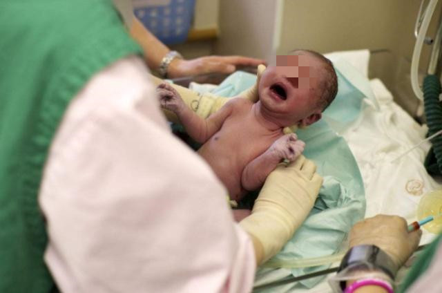 顺产和剖腹产哪个恢复快一些,顺产与剖腹产的利弊产后怎样恢复