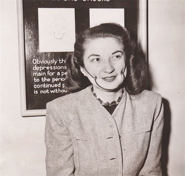 整形人工酒窝,人工做酒窝好看吗