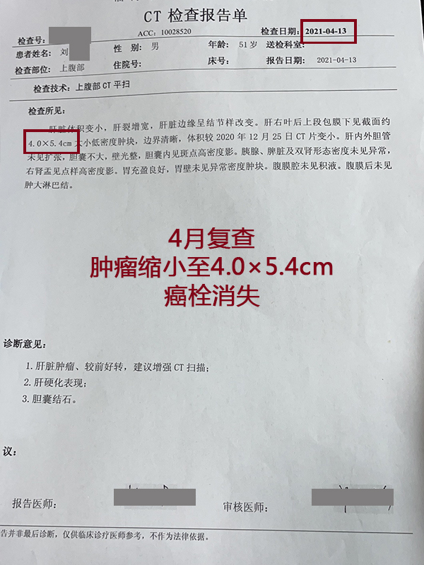 肝癌新发病例,肝癌肿瘤破裂出血会转移吗