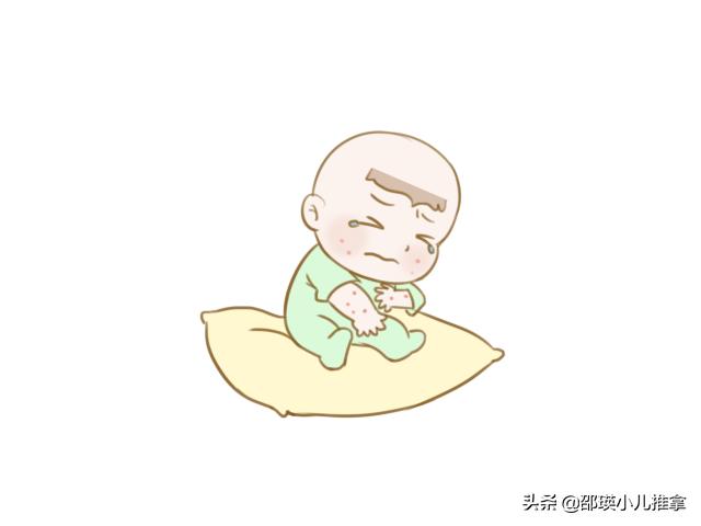 2岁孩子湿疹怎么消除又快又好,育儿湿疹怎样正确干预