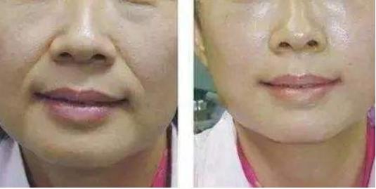 脖子三道颈纹的民间说法,脖子上有三道纹的命运